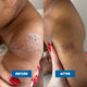 Before and after comparison of a person's knee with visible skin conditions.